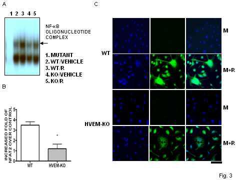 HVEM 부재시 RANKL signaling의 약화.