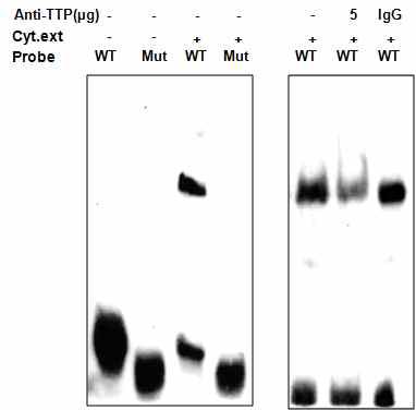 RNA EMSA 분석을 통한 TTP-IL-17 ARE 결합 확인