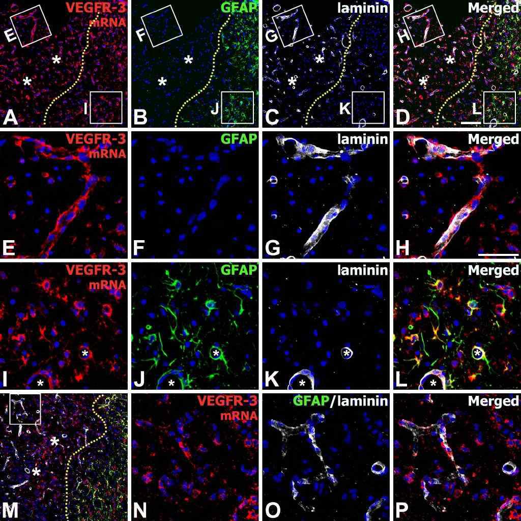 Induction of VEGFR-3 mRNA in vascular structures on days 3 (A–L) and 7 (M–P) after focal cerebral ischemia.