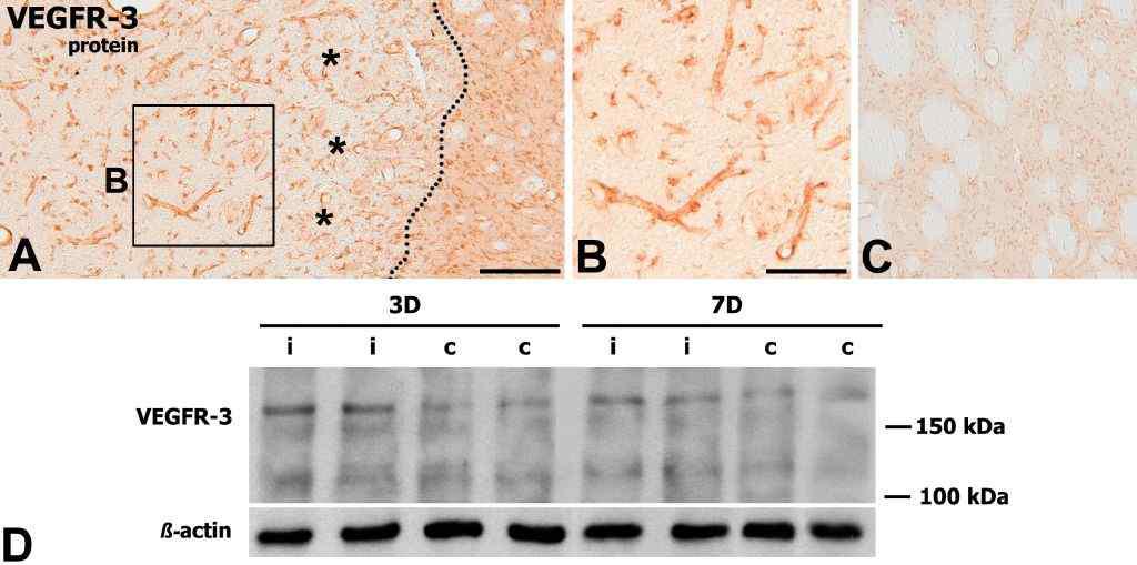 Induction of VEGFR-3 protein in vascular structures on days 3 (A–C) after focal cerebral ischemia.