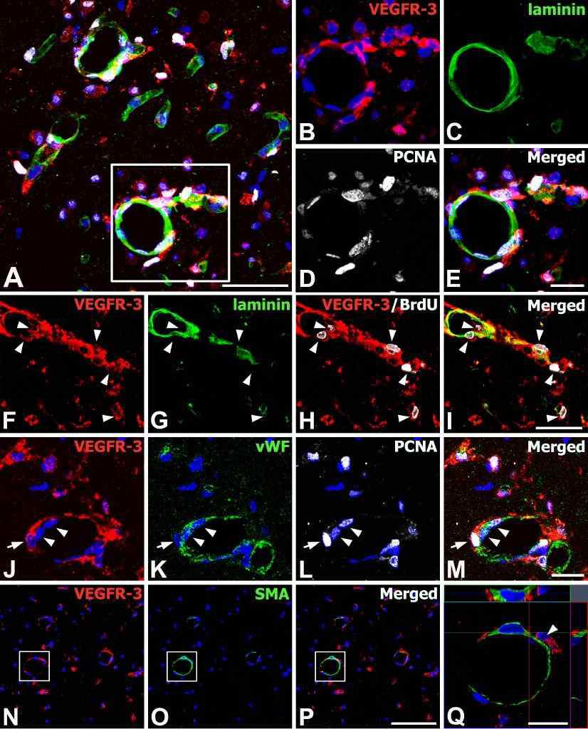 Characterization of vasculature-associated VEGFR-3-expressing cells in the core region of ischemic injury on day 3.