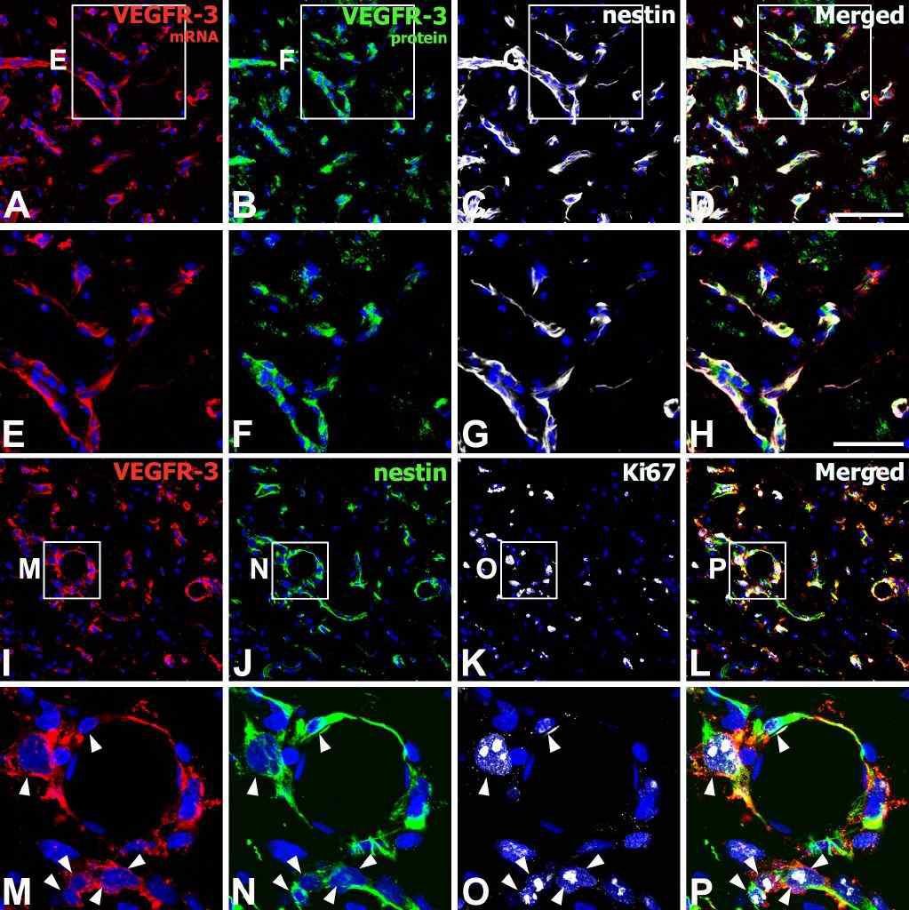 Characterization of vasculature-associated VEGFR-3-expressing cells in the core region of the ischemic injury on day 3.