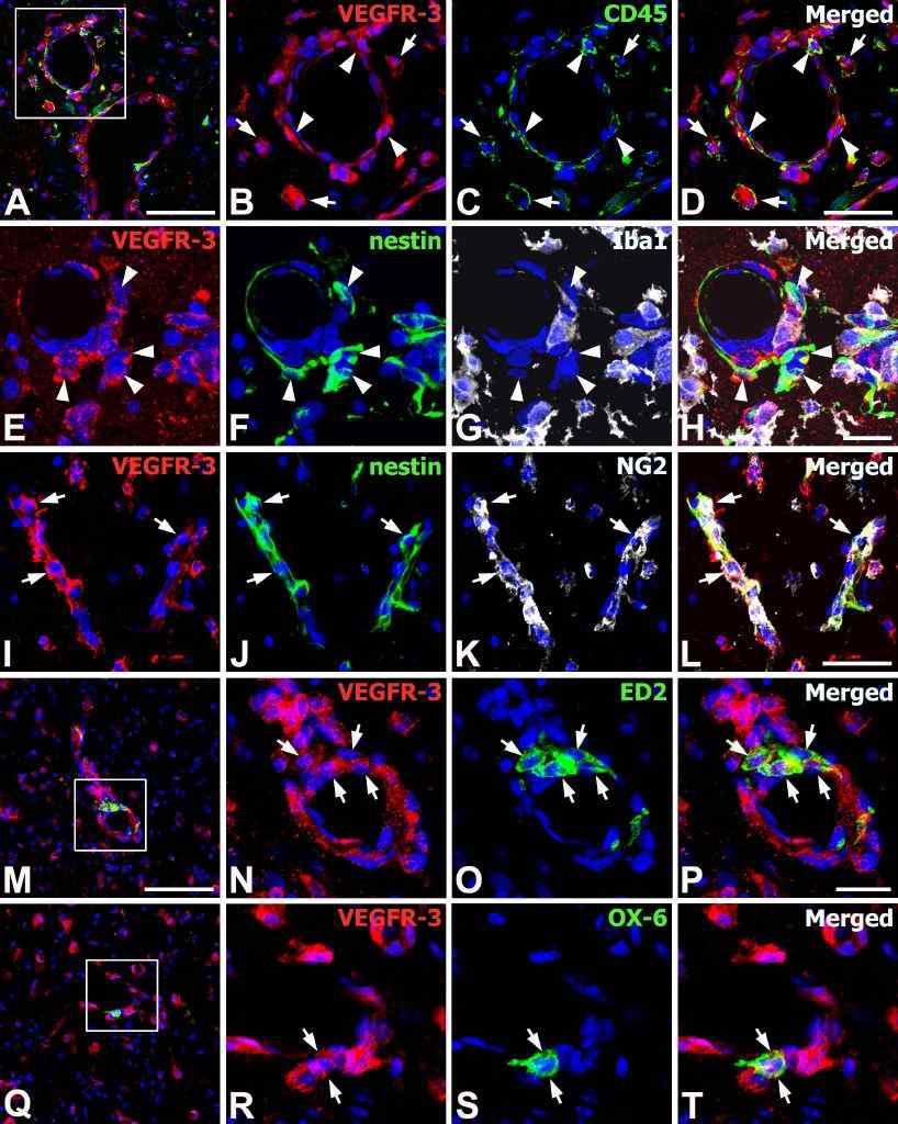 Phenotypes of vasculature-associated VEGFR-3 -expressing cells in the core region of the ischemic injury on day 3.