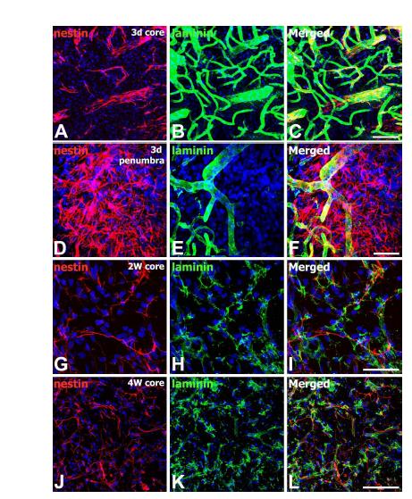 Spatiotemporal distribution of nestin expression in the ischemic core and peri-infarct region on days 3