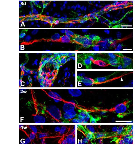 Characterization of nestin-positive cells in the core region of ischemic injury on days 3