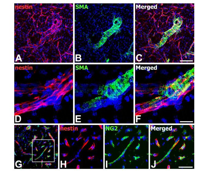 Characterization of nestin-positive cells in the core region of ischemic injury on day 3.