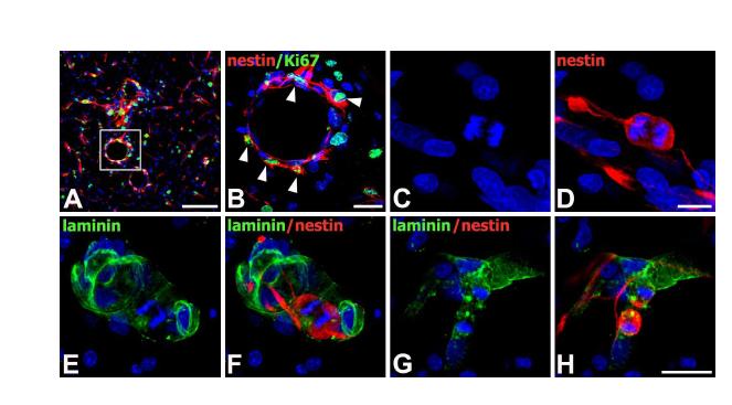 Characterization of nestin-positive cells in the core region of ischemic injury on day 3.