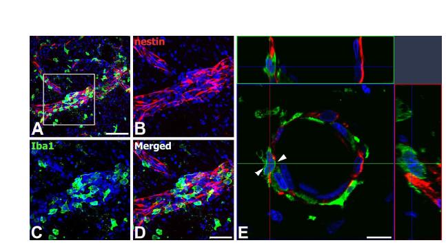 Characterization of nestin-positive cells in the core region of ischemic injury on day 3.