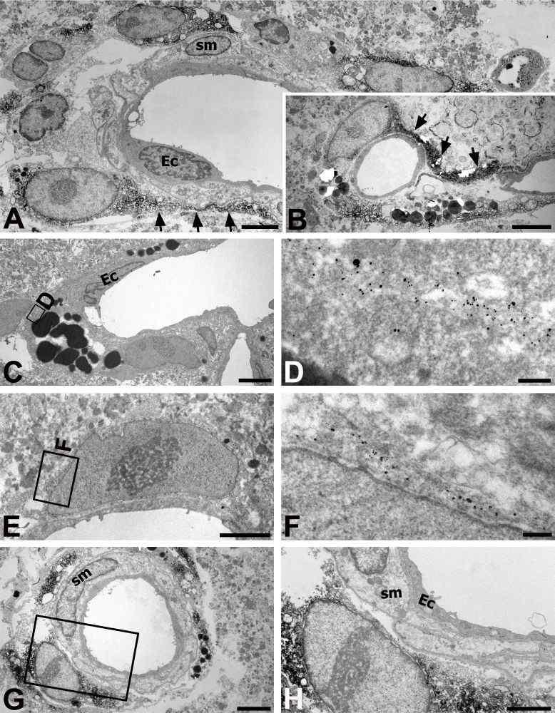 Ultrastructural features of nestin-positive cells in vessels of larger caliber