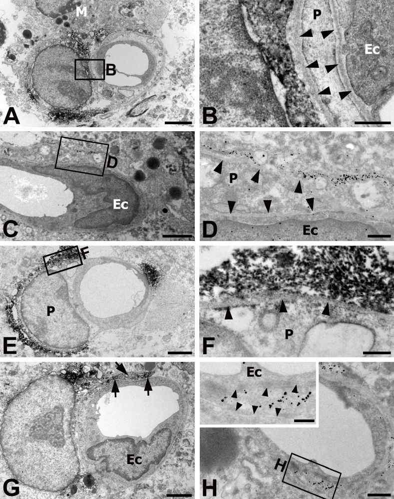 Ultrastructural features of nestin-positive cells in capillaries at 3 days postischemia by using immunoperoxidase