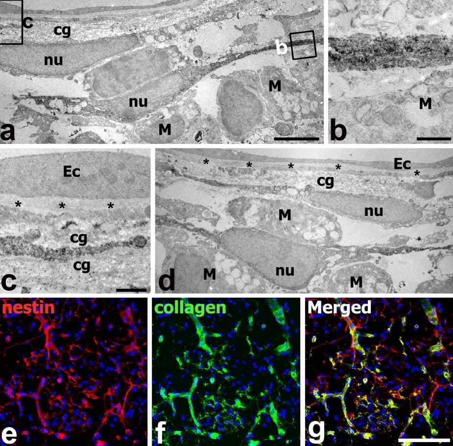 Characterizations of nestin-positive cells in the ischemic core at 14 days postischemia by using immunoperoxidase electron microscopy