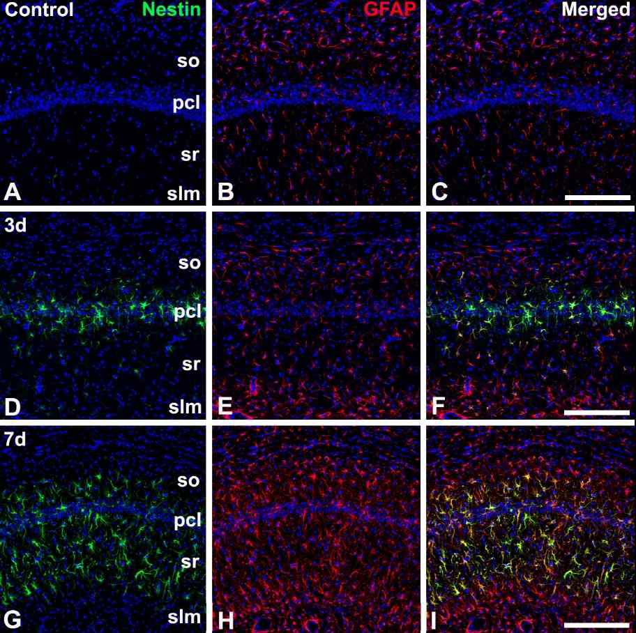 Spatiotemporal relationship between nestin and GFAP in the hippocampal CA1 region in the early phase following transient forebrain ischemia.