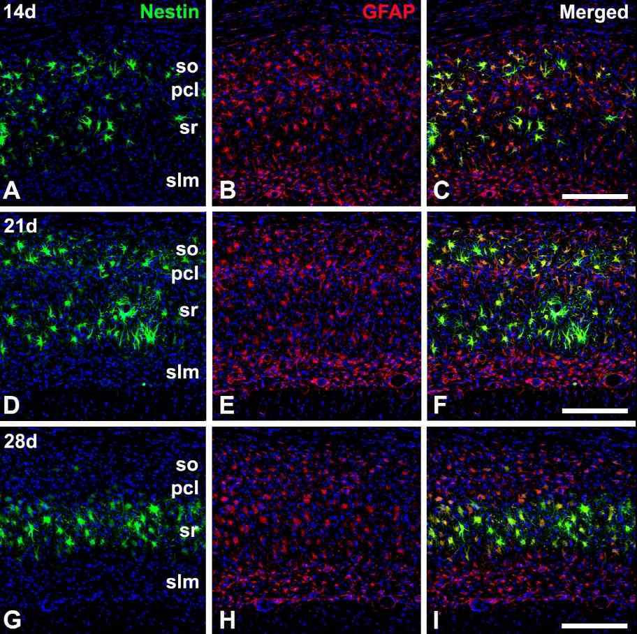 Spatiotemporal relationship between nestin and GFAP in the hippocampal CA1 region during the later phase following transient forebrain ischemia.