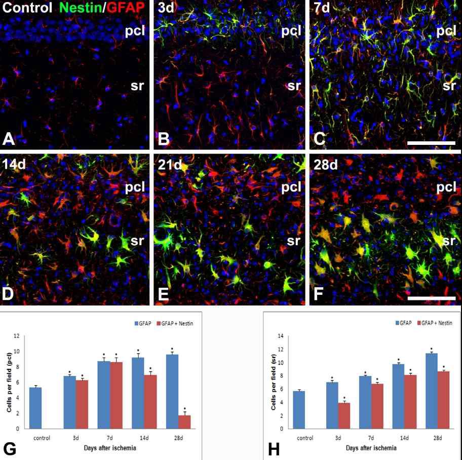 Spatiotemporal distribution of nestin-positive astrocytes in the CA1 hippocampus of control