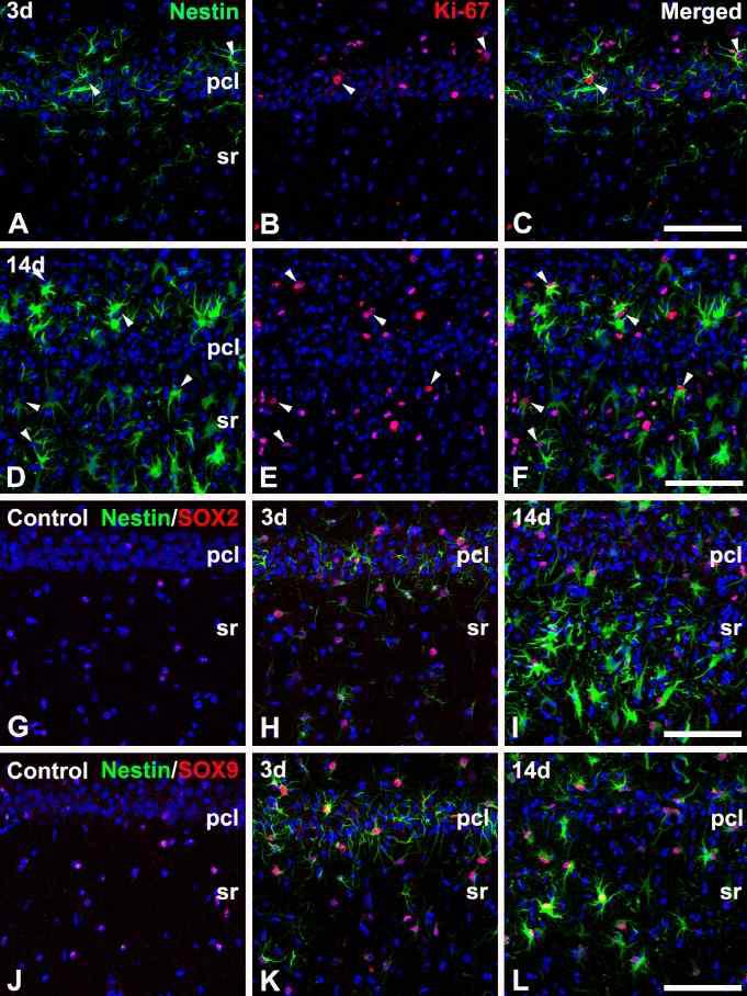 Characterization of nestin-positive cells in the CA1 hippocampal region after transient forebrain ischemia.