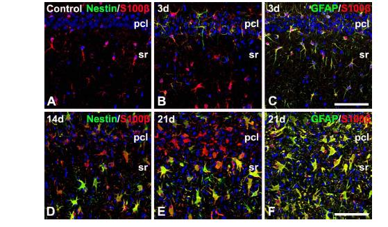 Relationship between S100β and nestin (A, B, D, E) or GFAP (C, F) in the CA1 hippocampal region after transient forebrain ischemia. All of the nestin-positive cells expressed S100β, corresponding to only a small fraction of all of the S100β -positive cells at all time points examined. Note that virtually all of the S100β-positive cells in the ischemic CA1 region were GFAP-positive astrocytes. Scale bars = 100 mm for A−F.