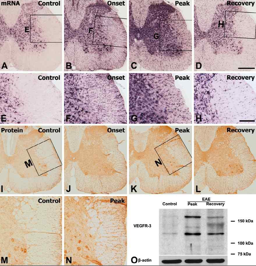 Spatial and temporal expression of VEGFR-3 mRNA