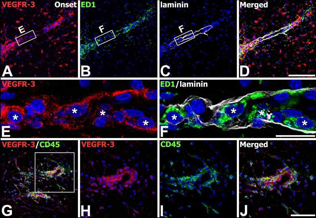 Identification of phenotypes of VEGFR-3-expressing cells in the lumbar spinal cords at the onset stage of EAE-affected rats.