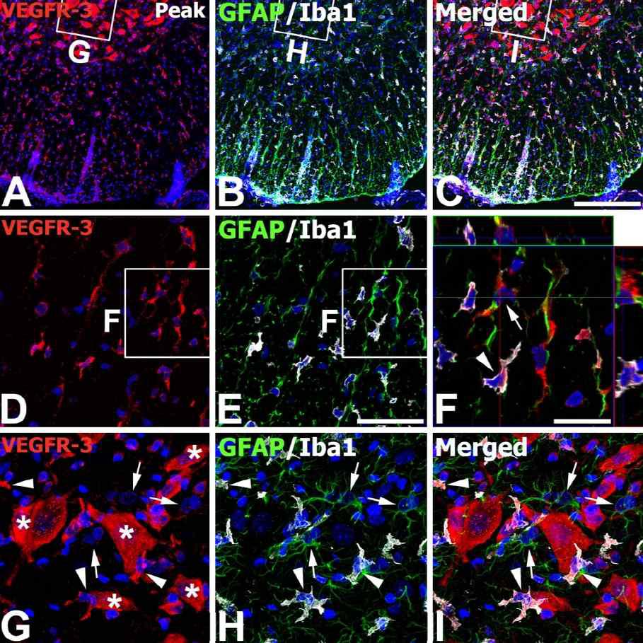 Identification of phenotypes of VEGFR-3-expressing cells in the lumbar spinal cords at the peak stage of EAE-affected rats.