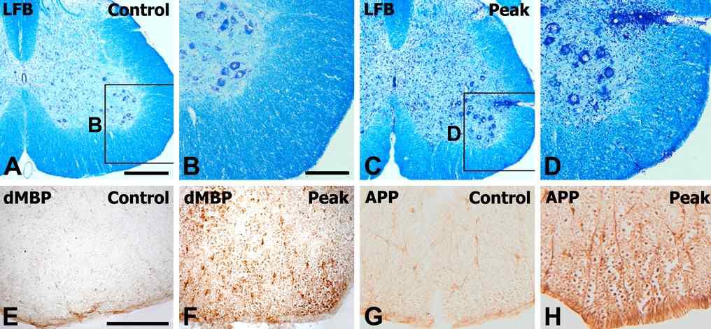 Histopathological features of control and EAE-affected rats.