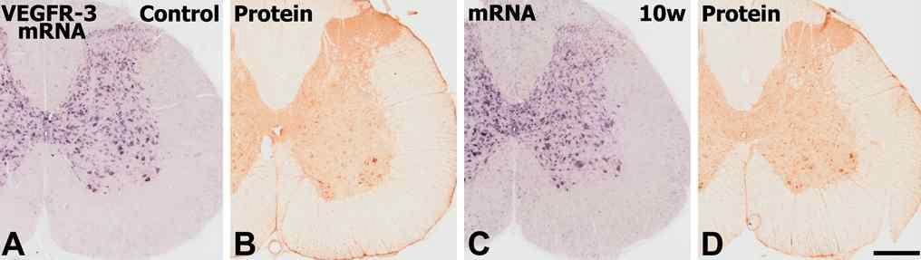 Expression of VEGFR-3 mRNA and protein in CFA controls