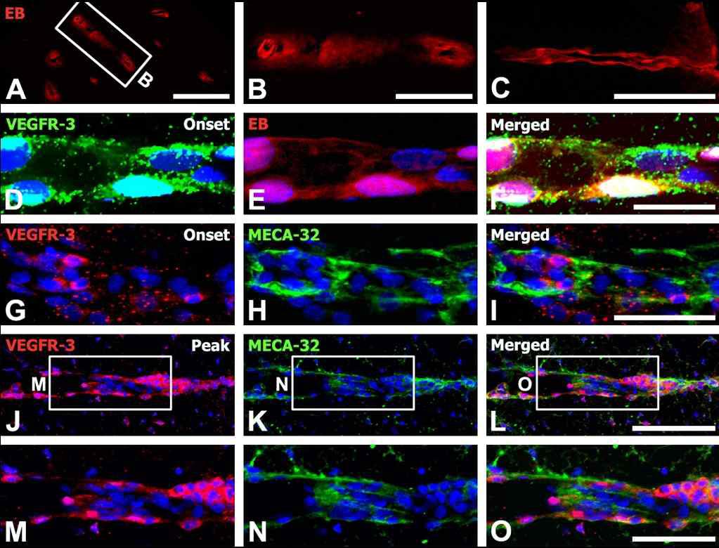 Relationship between VEGFR-3 expression and blood–brain barrier (BBB) damage in EAE-affected rats at onset