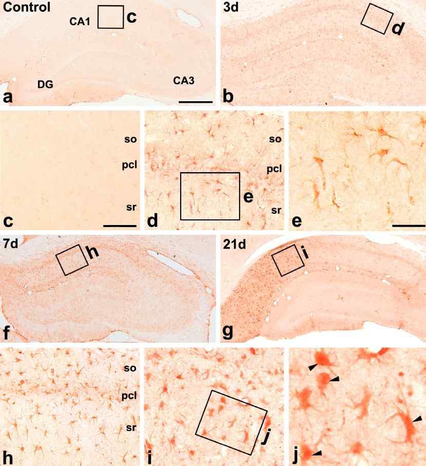 Changes in KLF4 expression in the hippocampus following transient forebrain ischemia.