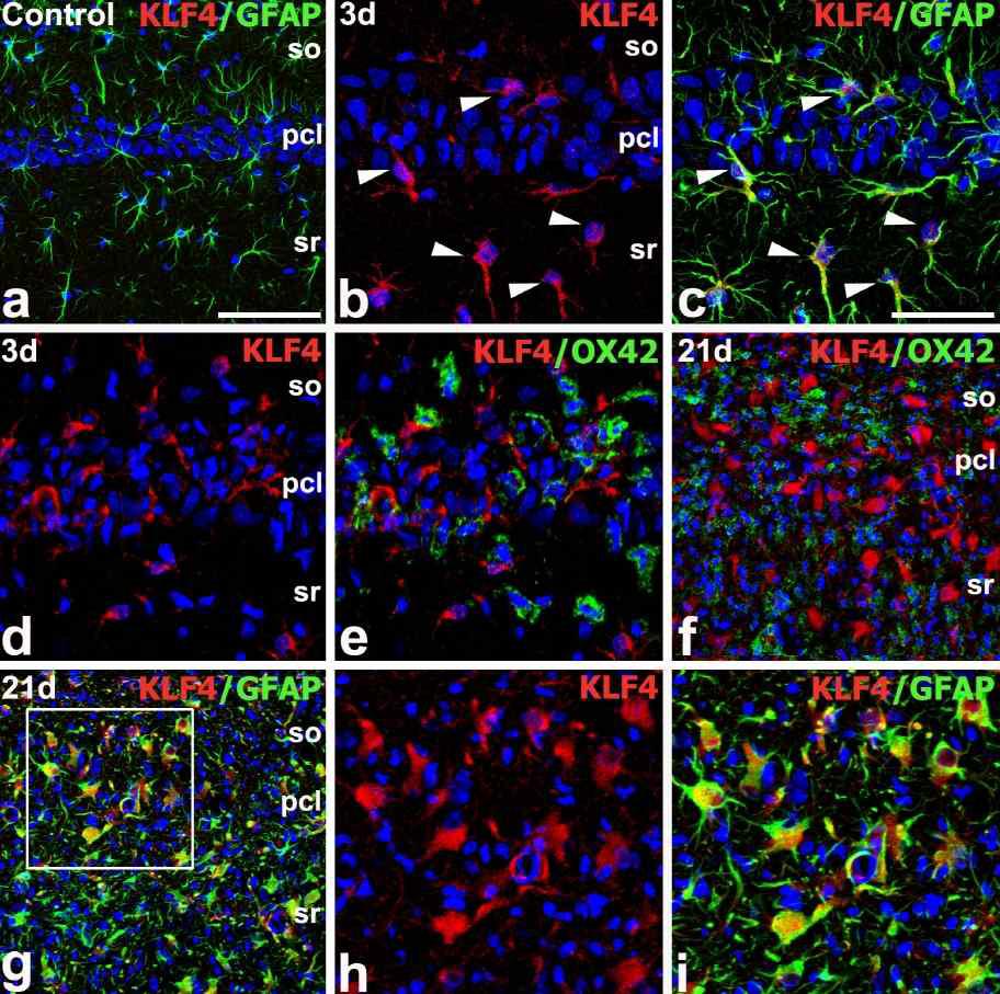 Identification of the phenotypes of KLF4-positive cells in the CA1 region of the hippocampus of control