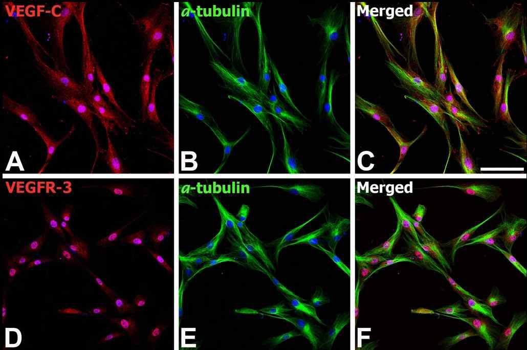 Expression of VEGF-C and VEGFR-3 protein by bone marrow-derived human mesenchymal stem cells (MSCs) in vitro. Double-labeling with VEGF-C