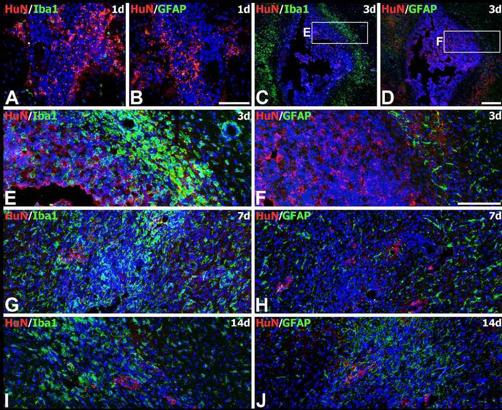 Spatial and temporal relationships between engrafted MSCs and astroglial and microglial responses in the striatum of MSC-grafted rats demonstrated by double-labeling with the human-specific marker (HuN) and well-established markers of astrocytes or microglia, glial fibrillary acidic protein (GFAP) or Iba1, respectively.