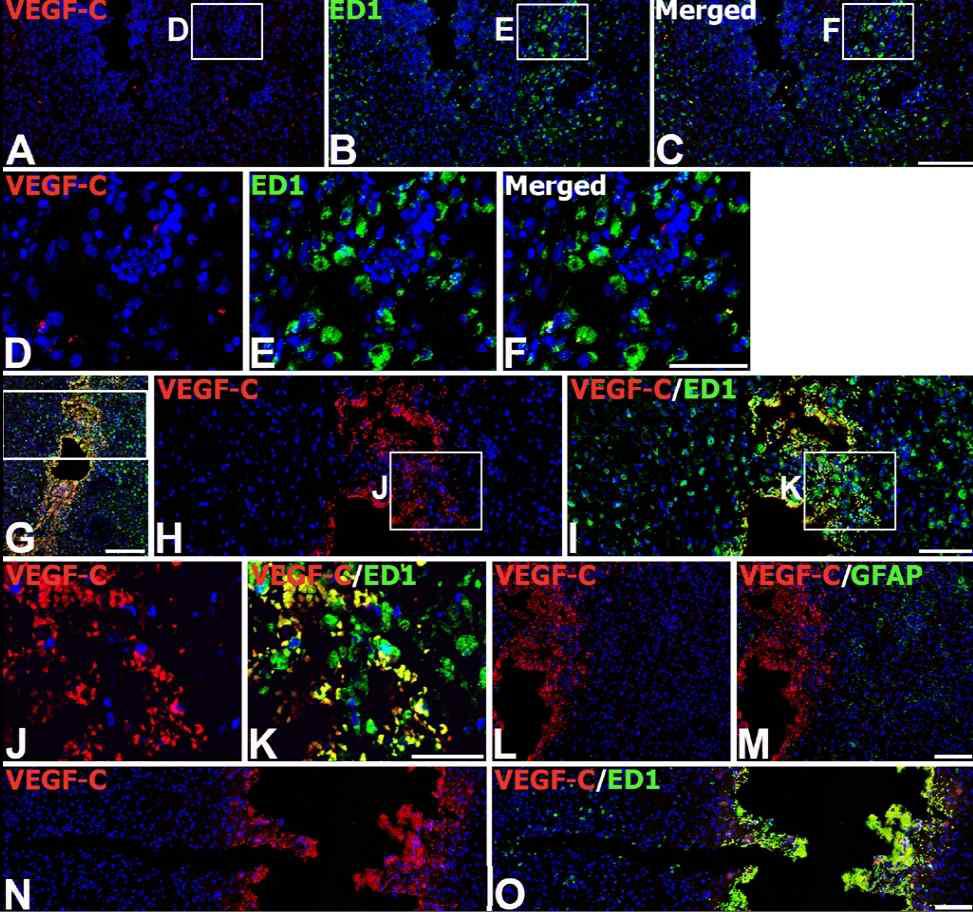 Spatiotemporal distribution of nestin-positive astrocytes in the CA1 hippocampus of control