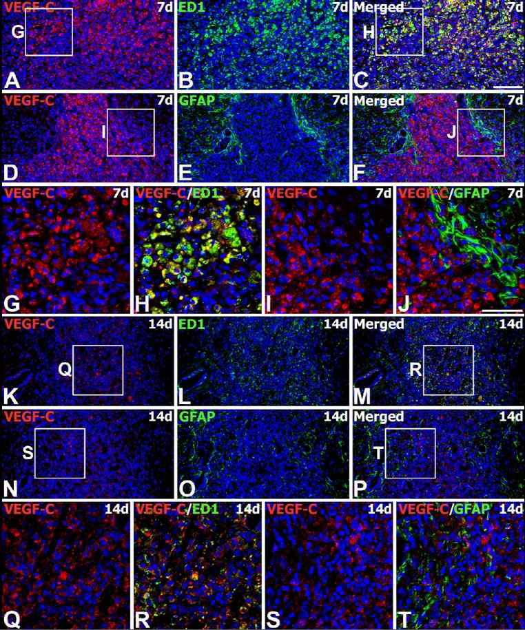 Spatiotemporal expression of VEGF-C protein in the striatum of MSC-grafted rats on days 7 and 14 after transplantation.