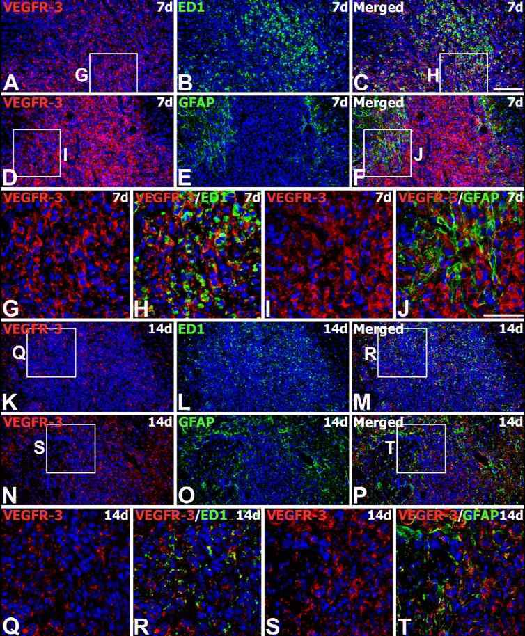 Spatiotemporal expression of VEGFR-3 protein in the striatum of MSC-grafted rats on days 7 and 14 after transplantation.