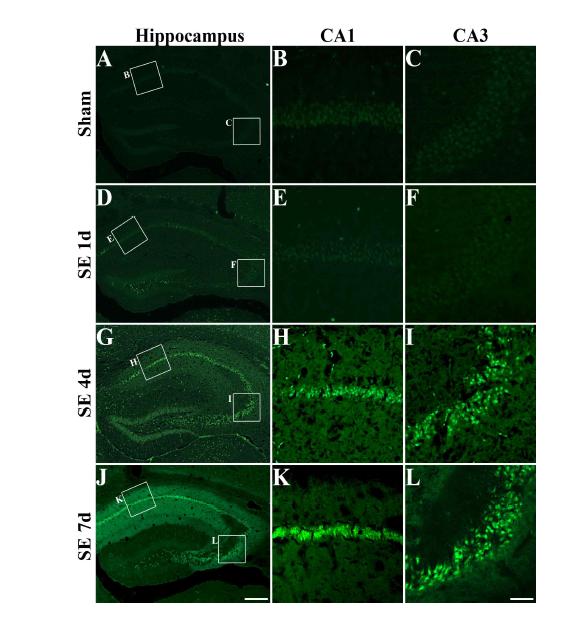 Temporal profiles of neuronal cell death determined by fluoro-jade staining in the hippocampus following pilocarpine administration. There were many intact neurons in the CA1 (B) and CA3 (C) of the hippocampus in sham-manipulated animals