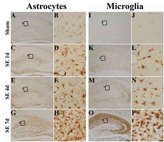 Temporal profiles of the expression of astrocytes (GFAP) and microglia (Iba-1) in the hippocampus following pilocarpine administration. Compared with a sham-manipulated animal, both GFAP-positive, Iba-1-positive cells were increased from 1 day after SE onset in the subpyramidal zone . Immunoreactivies to GFAP and Iba-1 are increased in time dependent manners at 4 days (and 7 days (after SE. Scale bar in (O) = 200 μm; Scale bar in (P) = 20 μm