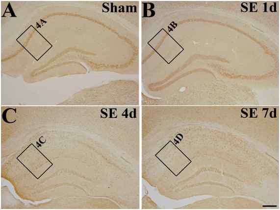 Temporal profiles of the expression of VEGF-C-positive cells analyzed by immunohistochemistry. There was no significant change at 1 day after SE (B) compared with sham-operated animals (A). However, VEGF-C-positive cells were markedly increased in the subpyramidal zone of the hippocampus at 4 days (C) and were peaked at 7 days (D) after pilocarpine-induced SE. Scale bar in (D) = 200 μm