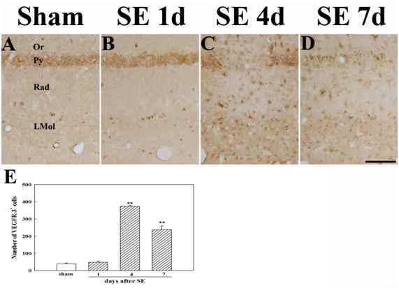 Temporal profiles of the expression of VEGFR-3-positive cells analyzed by immunohistochemistry (Higher magnification of Fig. 5). Immunoreactivity to VEGFR-3 was markedly increased at 4 days after pilocarpine-induced SE in the subpyramidal zone of the hippocampus (A-D and F). Cell counting was carried out in the area indicated in Fig. 4E. Scale bar in (D) = 100 μm. Values are expressed as mean ± SE, ** p<0.01vs.sham.