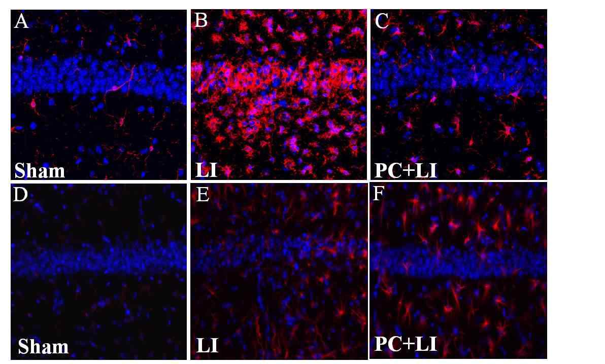 Effect of ischemic preconditioning on glial response in hippocampus after severe ischemia. Representative images of Iba-1 immunofluorescence of sham