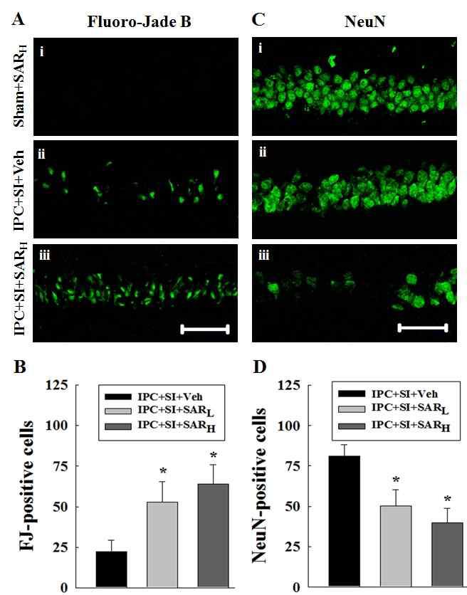 Blockade of IPC-induced ischemic tolerance by the VEGFR-3 inhibitor SAR131675.