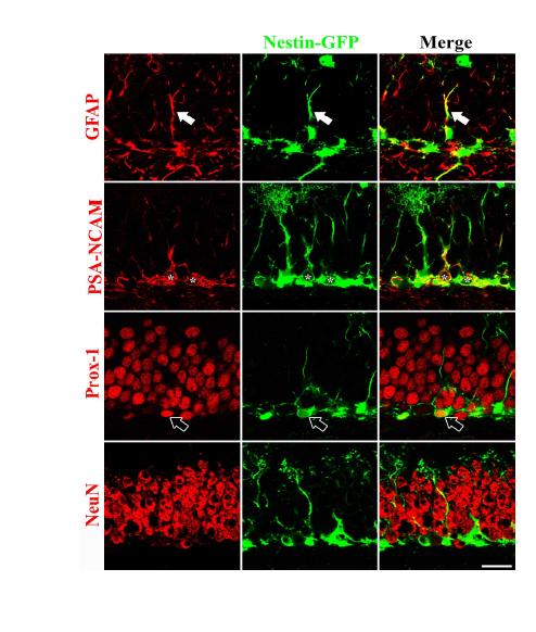 Expression pattern of nestin and neurogenesis-associated markers in nestin-GFP transgenic mice. Transgenic mice expressed nestin and various neural progenitor and mature neuronal markers, GFAP, PSA-NCAM, Prox-1 and NeuN in SGZ of hippocampus (x400). Nestin expression was co-labeled with GFAP, PSA-NCAM and Prox-1. Scale bar = 20 μm.