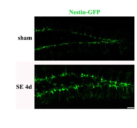 Expression pattern of nestin following pilocapine-induced SE in nestin-GFP transgenic mice. Nestin expression in SGZ of hippocampus was increased at 4 days after SE compared with sham group (x200). Scale bar = 50 μm.