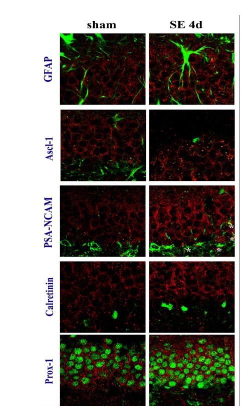 Change in expression of VEGFR-3 and neurogenesis markers in Nestin-GFP mice following pilocarpine administration. Expression of VEGFR-3 is moderately increased in granular neurons in hippocampal dentate gyrus. In sham group, no neurogenesis marker is colabeled with VEGFR-3. However, PSA-NCAM, early phase neuronal cell marker, is expressed in some VEGFR-3 expressing cells after 4 days of SE.