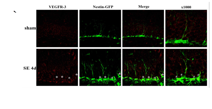 Change in expression of VEGFR-3 and Nestin-GFP in Nestin-GFP mice following pilocarpine administration. Expression of VEGFR-3 is moderately increased in granular neurons in hippocampal dentate gyrus. In sham group, none of VEGFR-3 -positive cell expressed Nestin-GFP. However, after 4 days of SE, Nestin-GFP expression was observed in many VEGFR-3 expressing cells.