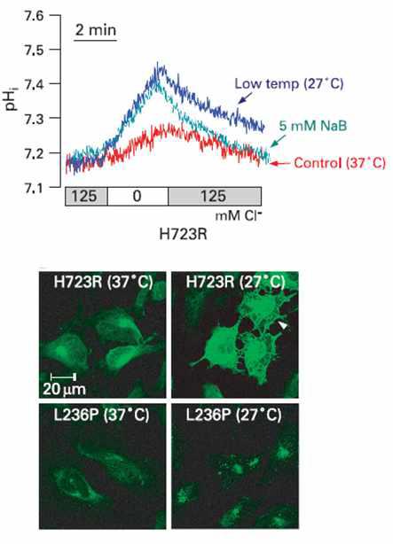 저온에 세포를 보관하거나 NaB를 투여하였을 때 H723R의 경우 펜드린이 세포막으로 이공하고 음이온교환기능도 회복되나, L236P는 이러한 현상이 나타나지 않음.