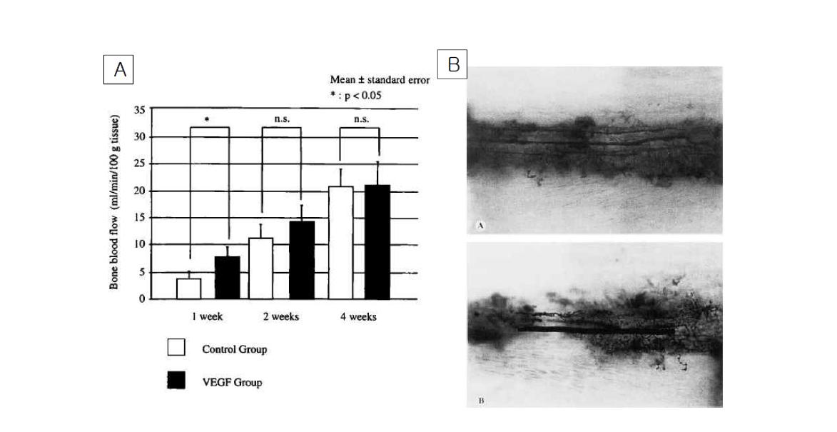 (A)VEGF gene transfer후 혈류증가를 일으킴. (B) 미세혈관조영술 소견. VEGF 투여군(B)에서 신생혈관형성이 관찰됨(Katsube K et al., J Orthop Res, 2005).