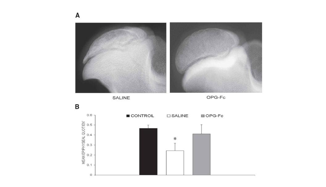대퇴골두 무혈성 괴사 동물 모델에서 파골세포 분화 억제제 OPG-Fc 투여후(A) 골파괴가 억제 되어 대조군에 비해 골두가 원형을 유지함. (B) 대퇴골두 원형도가 파골세포 분화 억제제 투여군에서 보존되고 있음(Kim HK et al., JBone Miner Res, 2006).