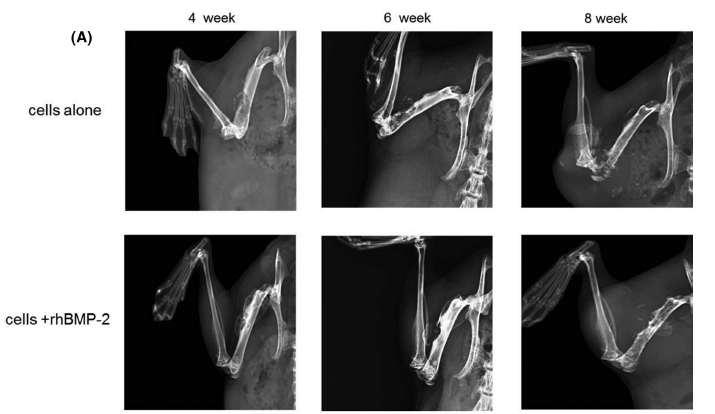 인간 유방암세포주 (MDA-MB-231 cells)에 rhBMP-2 처리군에서 대퇴골 종양조직 형성이 현저히 감소한 소견이 관찰됨.