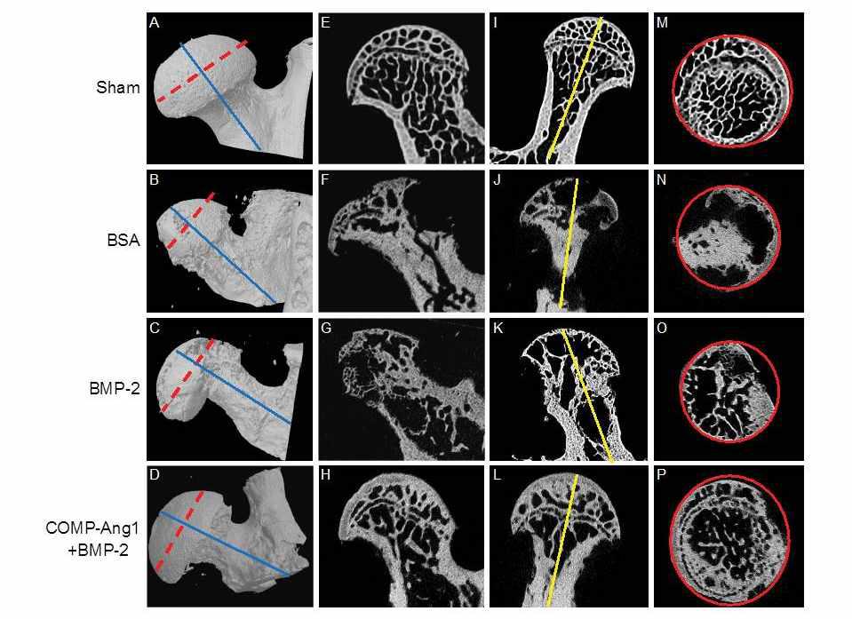 Representative micro-CT scan images of infarcted femoral heads in the BSA, BMP-2, and COMP-Ang1 + BMP-2 groups. Shown are femoral heads obtained from the infarcted area eight weeks after surgery-induced avascular necrosis. Femoral heads showed significant loss of trabecular bone and deformity in the BSA group (B, F, J, N). Femoral heads in the BMP-2 group (C, G, K, O) showed a prominent bone resorption area, but maintained femoral head shape as compared with the BSA group. The trabecular network and femoral head architecture were well preserved in the COMP-Ang1 +BMP-2 group (D, H, L, P). The ROIs (solid red lines) of each group (M, N, O, P) were obtained from the cross-sectional area of the middle of the femoral head (dotted red lines). The sagittal images (I, J, K, L) were formed by the cross-sectional area of the blue lines perpendicular to the dotted red lines, and the coronal images (E, F, G, H) were formed by the cross-sectional area of yellow lines.