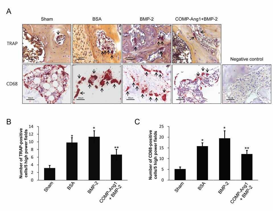 TRAP staining and immunohistochemical staining for CD68 in the femoral head.