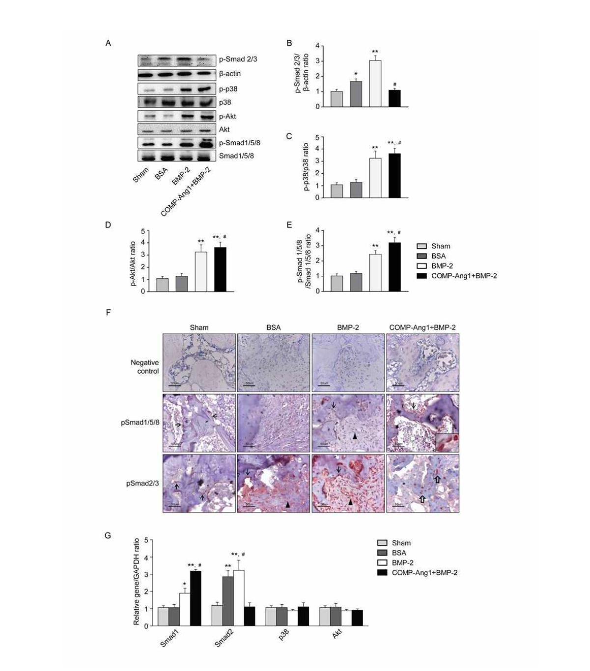 Western blot analysis and immunohistochemical staining of infarcted femoral heads eight weeks after BMP-2 and COMP-Ang1 treatment. Femoral head tissue obtained from defect sites was ground and extracted with protein lysis buffer. Western blot analysis